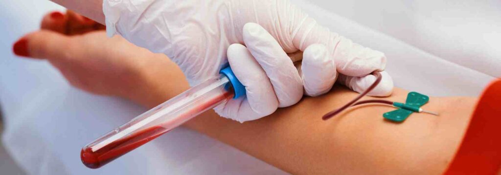 Book private blood tests in London at Chelsea Green Pharmacy. 