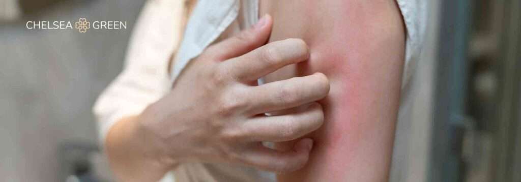 Book private allergy testing near me.