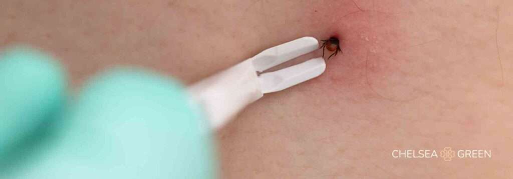 Pack a travel first aid kit for tick bites, sunburn, and more. 