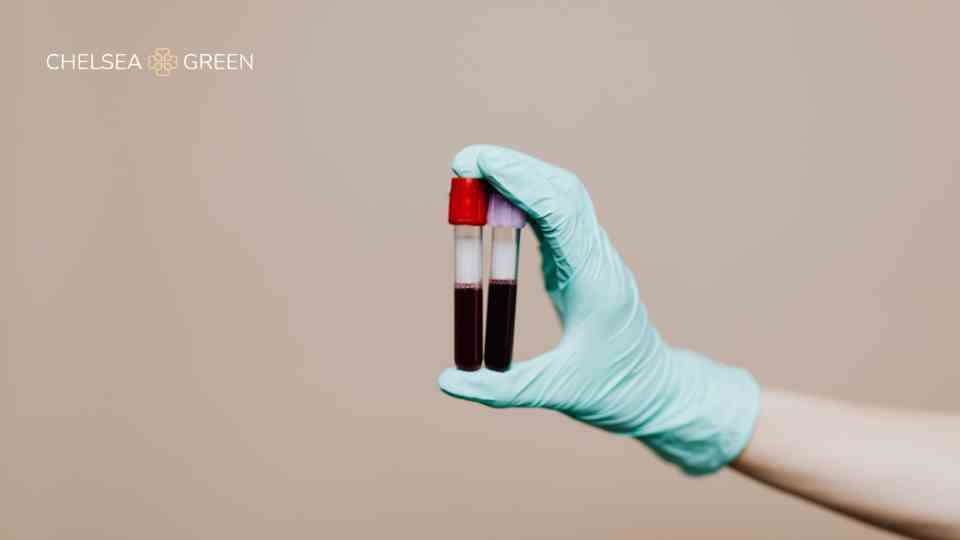 Blood test to detect cancer near me