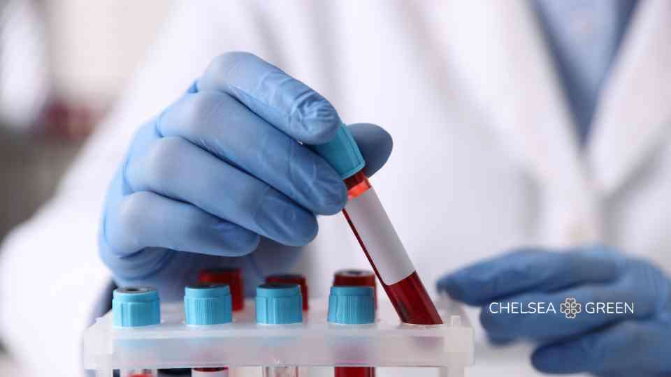 Test tubes for blood testing