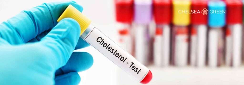 Cholesterol testing