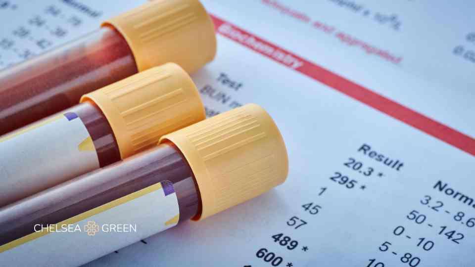 Blood test tubes and results