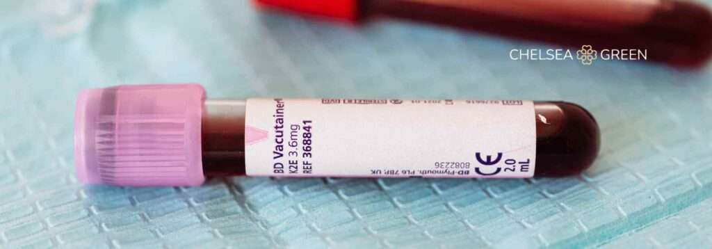 Blood test tube