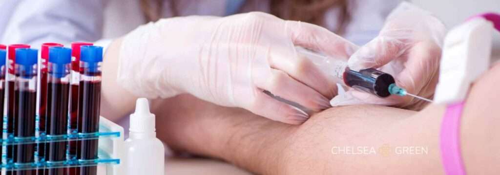 Getting a MVP blood test