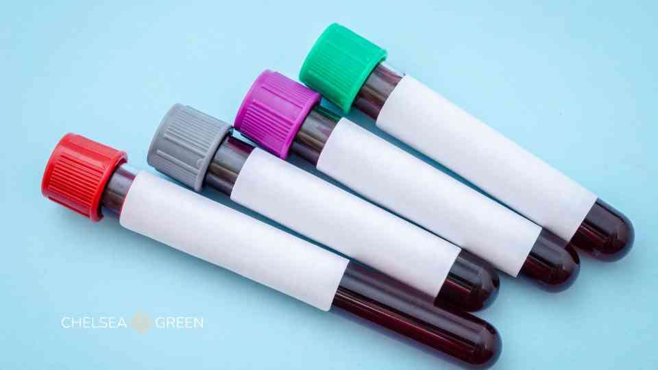 Blood testing tubes