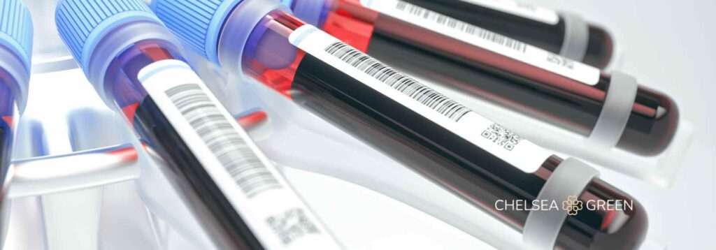 Blood test tubes for private testing in London