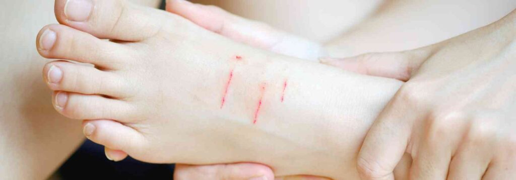 Rare side effects of the rabies vaccine