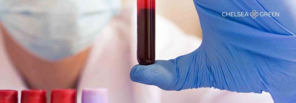 Test tube for blood testing in London