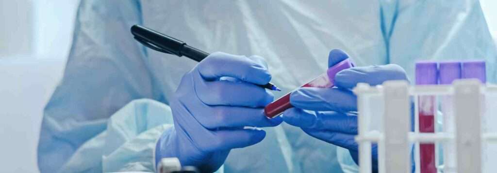 Blood test tube in a lab