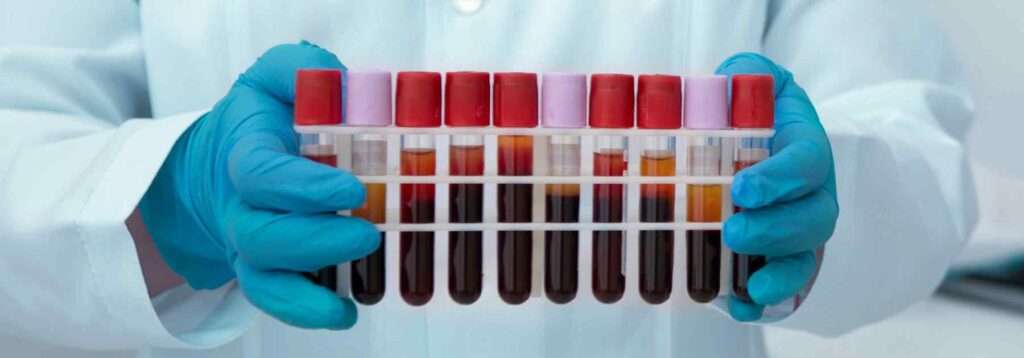 Blood test tubes