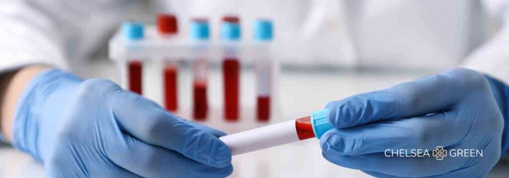 Pharmacist holding a blood test tube. 