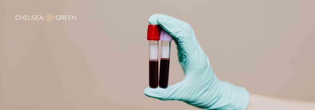 Blood testing tubes