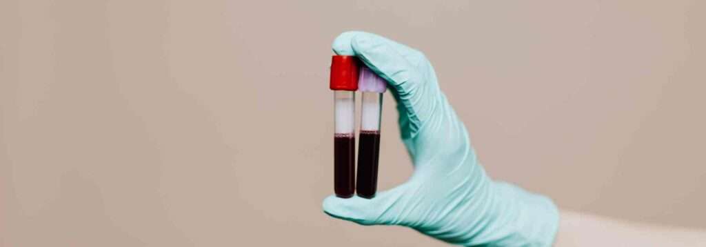 Blood test tubes